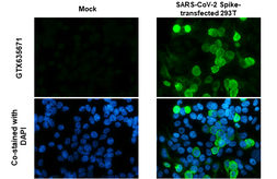 Anti-SARS-CoV-2 (COVID-19) Spike S1 antibody [HL134] used in Immunocytochemistry/ Immunofluorescence (ICC/IF). GTX635671