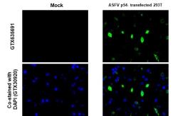 Anti-ASFV p54 antibody [GT1075] used in IHC (Paraffin sections) (IHC-P). GTX635691