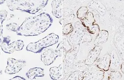 Anti-SARS-CoV-2 (COVID-19) Spike RBD antibody [HL257] used in IHC (Paraffin sections) (IHC-P). GTX635692