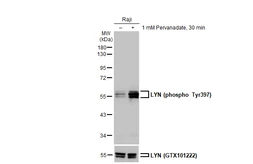 Anti-LYN (phospho Tyr397) antibody [HL122] used in Western Blot (WB). GTX635694