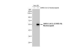 Anti-SARS-CoV-2 (COVID-19) Nucleocapsid antibody [HL455-MS] used in Western Blot (WB). GTX635712