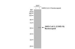 Anti-SARS-CoV-2 (COVID-19) Nucleocapsid antibody [HL455-MS] used in Western Blot (WB). GTX635712