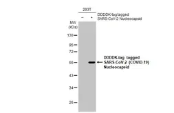 Anti-SARS-CoV-2 (COVID-19) Nucleocapsid antibody [HL455-MS] used in Western Blot (WB). GTX635712
