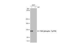 Anti-FAK (phospho Tyr576) antibody [HL127] used in Western Blot (WB). GTX635714