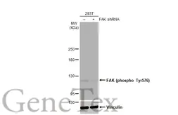 Anti-FAK (phospho Tyr576) antibody [HL127] used in Western Blot (WB). GTX635714