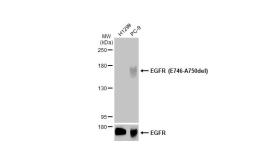 Anti-EGFR (E746-A750del) antibody [HL363] used in Western Blot (WB). GTX635716