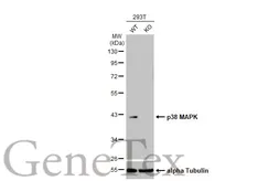 Anti-p38 MAPK antibody [HL1006] used in Western Blot (WB). GTX635797