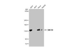 Anti-SMCR8 antibody [HL1007] used in Western Blot (WB). GTX635798