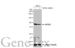 Anti-VPS35 antibody [HL1017] used in Western Blot (WB). GTX635821