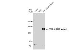 Anti-EGFR (L858R Mutant) antibody [HL1022] used in Western Blot (WB). GTX635834