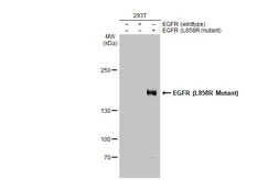 Anti-EGFR (L858R Mutant) antibody [HL1022] used in Western Blot (WB). GTX635834