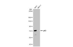 Anti-p63 antibody [HL1027] used in Western Blot (WB). GTX635841
