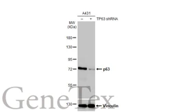Anti-p63 antibody [HL1027] used in Western Blot (WB). GTX635841
