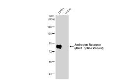 Anti-Androgen Receptor (ARv7 Splice Variant) antibody [HL1028] used in Western Blot (WB). GTX635842