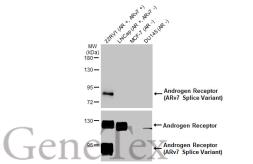 Anti-Androgen Receptor (ARv7 Splice Variant) antibody [HL1028] used in Western Blot (WB). GTX635842