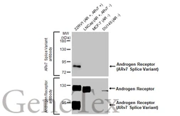 Anti-Androgen Receptor (ARv7 Splice Variant) antibody [HL1028] used in Western Blot (WB). GTX635842