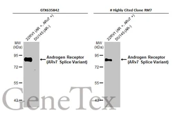 Anti-Androgen Receptor (ARv7 Splice Variant) antibody [HL1028] used in Western Blot (WB). GTX635842