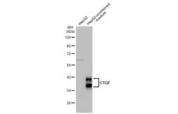 Anti-CTGF antibody [GT28711] used in Western Blot (WB). GTX635865