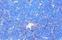 Anti-GRK2 (phospho Ser670) antibody [HL1035] used in IHC (Paraffin sections) (IHC-P). GTX635875