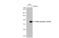 Anti-GRK2 (phospho Ser670) antibody [HL1035] used in Western Blot (WB). GTX635875