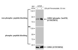 Anti-GRK2 (phospho Ser670) antibody [HL1035] used in Western Blot (WB). GTX635875