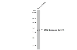 Anti-GRK2 (phospho Ser670) antibody [HL1035] used in Western Blot (WB). GTX635875