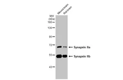 Anti-Synapsin II antibody [GT387] used in Western Blot (WB). GTX635883