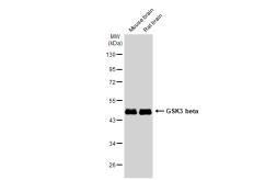 Anti-GSK3 beta antibody [GT1619] used in Western Blot (WB). GTX635886