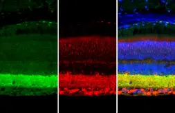 Anti-Synapsin II antibody [GT1446] used in IHC (Paraffin sections) (IHC-P). GTX635894
