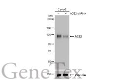 Anti-ACE2 antibody [GT19410] used in Western Blot (WB). GTX635897