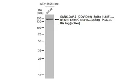 Anti-SARS-CoV-2 (COVID-19) Spike S2 / S2' antibody [HL1039] used in Western Blot (WB). GTX635911
