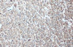 Anti-EpCAM antibody [GT25512] used in IHC (Paraffin sections) (IHC-P). GTX635967