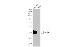 Anti-EpCAM antibody [GT3188] used in Western Blot (WB). GTX635970