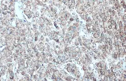 Anti-EpCAM antibody [GT3188] used in IHC (Paraffin sections) (IHC-P). GTX635970