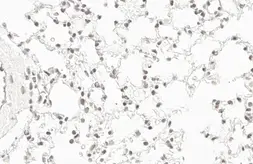 Anti-RPB2 antibody [HL1042] used in IHC (Paraffin sections) (IHC-P). GTX635976
