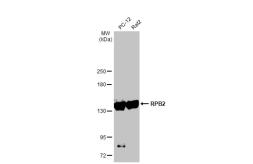 Anti-RPB2 antibody [HL1043] used in Western Blot (WB). GTX635977