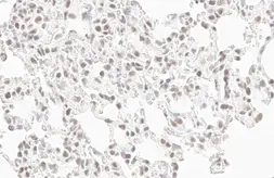 Anti-RPB2 antibody [HL1043] used in IHC (Paraffin sections) (IHC-P). GTX635977