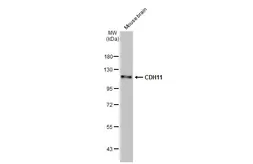 Anti-CDH11 antibody [HL1044] used in Western Blot (WB). GTX635978