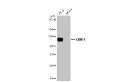 Anti-CDH11 antibody [HL1044] used in Western Blot (WB). GTX635978