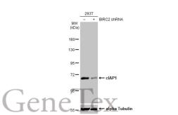 Anti-cIAP1 antibody [HL1045] used in Western Blot (WB). GTX635979