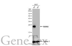 Anti-RAB6A antibody [HL1047] used in Western Blot (WB). GTX635981
