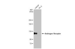 Anti-Androgen Receptor antibody [HL1049] used in Western Blot (WB). GTX636021