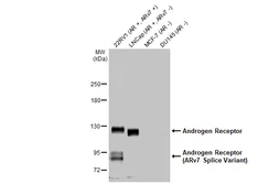 Anti-Androgen Receptor antibody [HL1049] used in Western Blot (WB). GTX636021