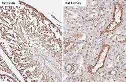 Anti-Androgen Receptor antibody [HL1049] used in IHC (Paraffin sections) (IHC-P). GTX636021