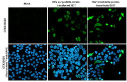 Anti-Hepatitis D virus Large delta + Small delta protein antibody [HL1053] used in Immunocytochemistry/ Immunofluorescence (ICC/IF). GTX636028
