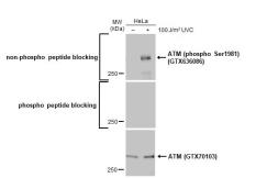 Anti-ATM (phospho Ser1981) antibody [HL1062] used in Western Blot (WB). GTX636086