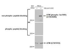 Anti-ATM (phospho Ser1981) antibody [HL1062] used in Western Blot (WB). GTX636086