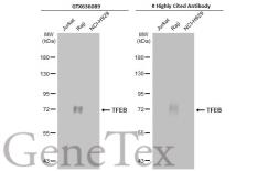 Anti-TFEB antibody [HL1065] used in Western Blot (WB). GTX636089