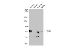 Anti-TFEB antibody [HL1065] used in Western Blot (WB). GTX636089