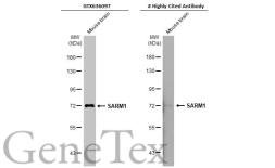 Anti-SARM1 antibody [HL1066] used in Western Blot (WB). GTX636097